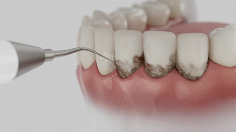 Trusted Wisdom Tooth Removal service in Scottsboro, AL - Dentist Open Now